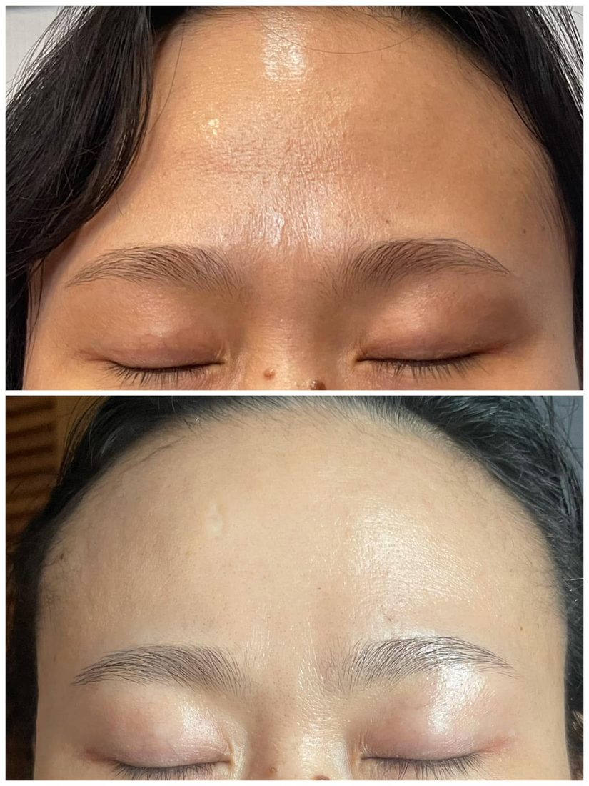 Kết quả trước và sau tại Her S Spa Saigon